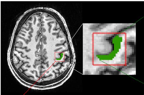 Stagg Group | mrcbndu