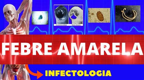 FEBRE AMARELA CAUSAS SINTOMAS DIAGNÓSTICO E TRATAMENTO