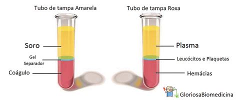 Soro X Plasma