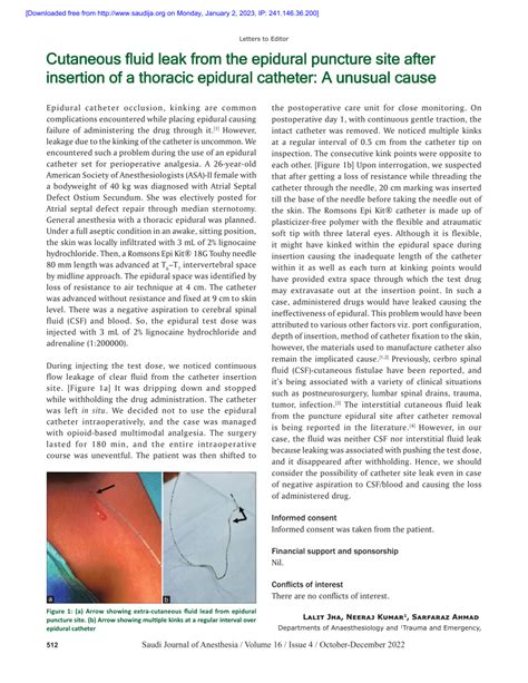 PDF Cutaneous Fluid Leak From The Epidural Puncture Site After