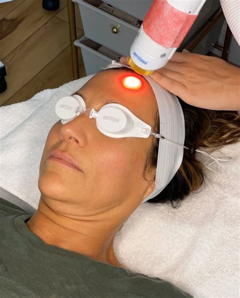 Laser Treatments Skindeep Aesthetics