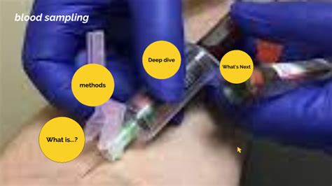 Blood Sampling By Shuruq Alotibi On Prezi