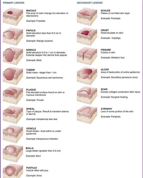 Primary Skin Lesions Chart