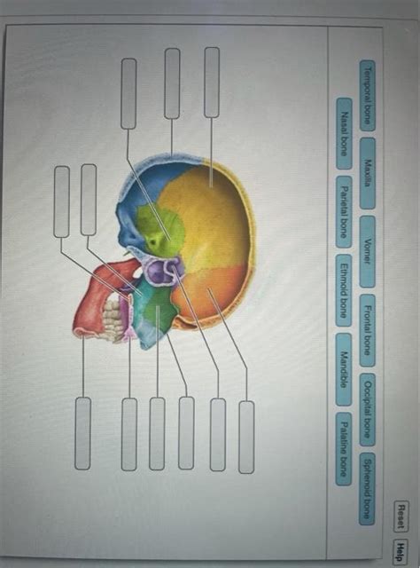 Solved Reset Help Temporal Bone Maxilla Vomer Frontal Bone