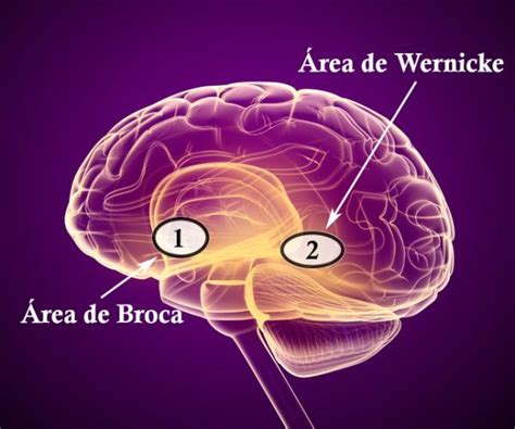 Tipos De Afasia Caracter Sticas Y Ejemplos