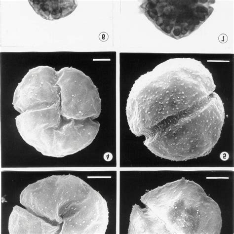 Gymnodinium sp. 1 (Figs. 2,3,7) and Gymnodinium sp. 2 (Figs. 4-6). Fig.... | Download Scientific ...