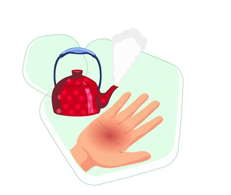 Термический ожог: оказание первой помощи, лечение