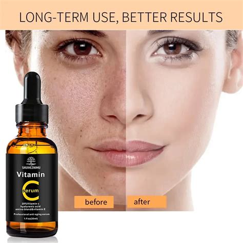 Private Label Skincare Natural Vitamin C Serum Hyaluronic Acid