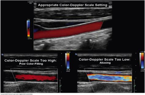 Ultrasound Physics Spr 2024 Test 1 Chapt 19 Flashcards Quizlet