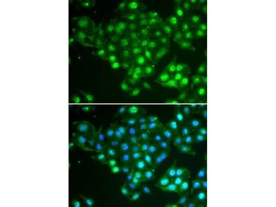 ABCA3 Polyclonal Antibody MBS9125772 From MyBioSource Biocompare