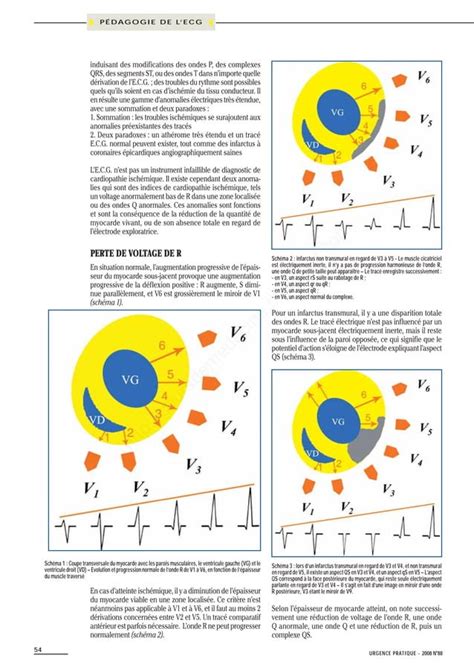 L ecg pour les nuls pédagogie de l ecg PDF