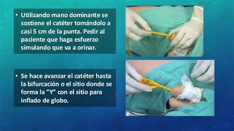 Colocación De Sonda Foley En Hombre Y Mujer Sondaje Vesical