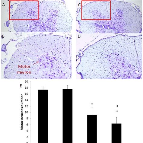 Ventral Horn Motor Neuron Survival Lumbar Spinal Cord Sections Were Download Scientific