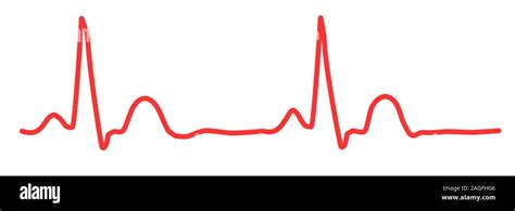 Ecg Graph Hi Res Stock Photography And Images Alamy