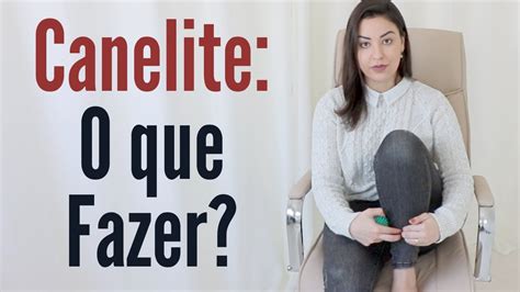 Canelite O Que Causa E Como Resolver Sa De Minuto Youtube