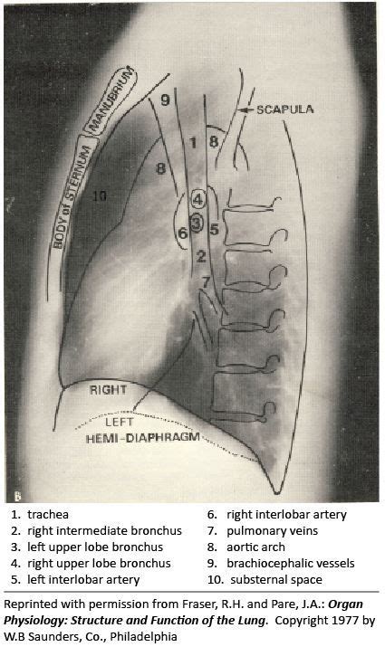 Pin By Aleksandra Stawik On Medyczne In 2024 Medical Radiography