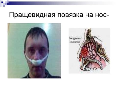 Десмургия - презентация онлайн