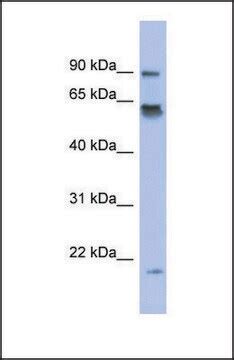 LRRFIP1 Antibody Western SAB2104582