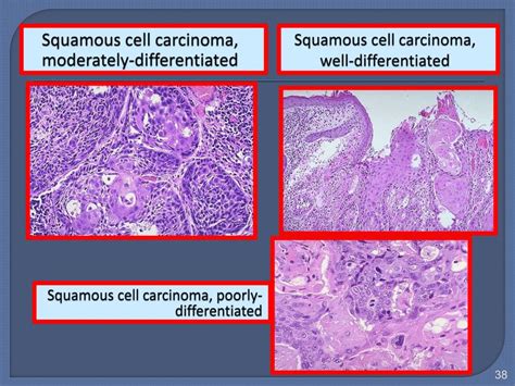 Ppt Neoplasia Powerpoint Presentation Free Download Id 6161338