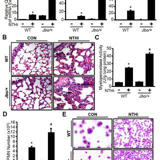 EVI1 Negatively Regulates Bacteria Induced Inflammation In The Lung Of