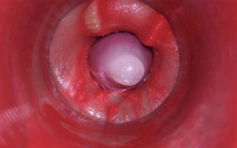 Camera Inside Pussy Powerfull Cum In Pussy Best Internal Asmr In 4k More Sperm Gay Porn XHamster
