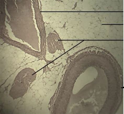 Histology: arteries vs veins Diagram | Quizlet