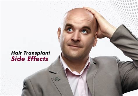 Managing Hair Transplant Side Effects: Expert Insights and Tips