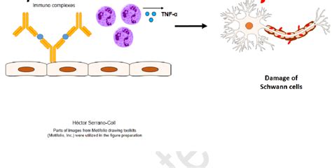 Type 2 leprosy reaction (T2LR) as an indirect mechanism of nerve damage | Download Scientific ...