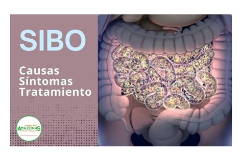 SIBO: Causas, síntomas y tratamiento