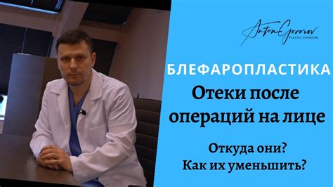 Отеки после операций на лице | Откуда они? | Как избавиться от отеков ...