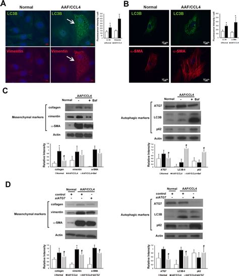 Effect Of Autophagy On The Mesenchymal Phenotype Of Ductular Cells From