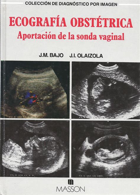 Ecografia Obstétrica con la sonda vaginal Blog de Tomás Cabacas