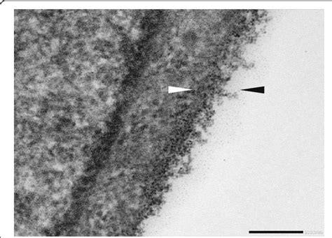 Electron Microscopy Of Endothelial Glycocalyx In Human Umbilical Vein