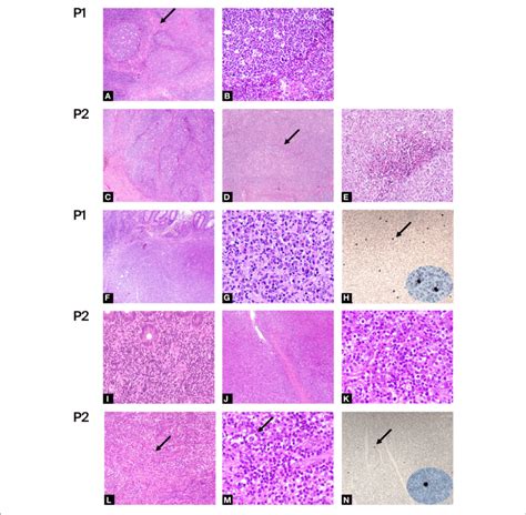 Histologic Evaluations A E Hematoxylin Eosin Of Benign Lymph Node