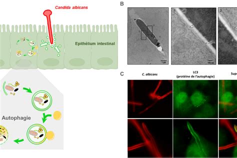 Membrane Protective Role Of Autophagic Machinery During Infection Of