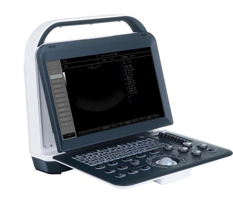 Portable Full Digital Color Doppler Uitrasound Scanner Ultrasound