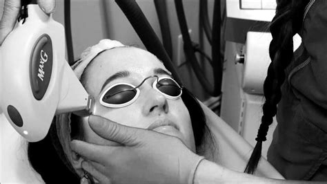 Ipl Skin Rejuvenation — Cosmetic Laser Clinic