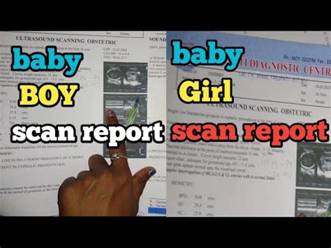 9th Month Growth Scan Reports Girl And Boy Report Baby Boy And Baby