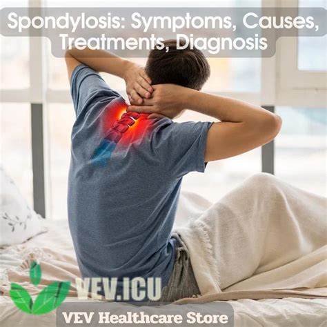 Spondylosis: Symptoms, Causes, Treatments, Diagnosis