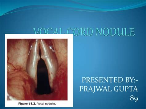Vocal cord nodule | PPTX