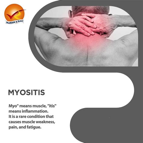 Myositis | The DADA2 Foundation