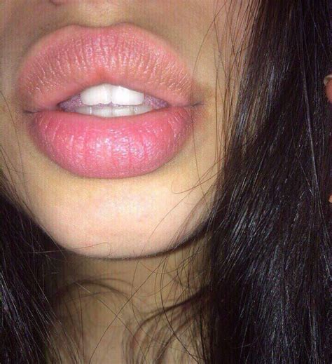 Lip Injections Lip Plumper Botox Big Lips Natural Maquillage On Fleek Juicy Lips Plump