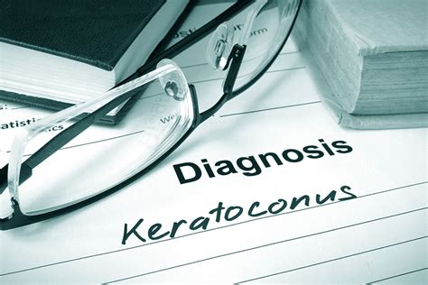 Keratoconus Treatment In Auckland See John Oconnor Optometrists