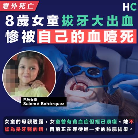 【意外死亡】哥倫比亞8歲女童找牙醫拔牙 竟被自己的血噎到致窒息身亡 Health Concept