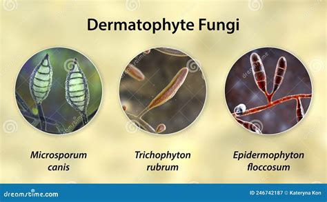 Dermatophyte Fungi 3d Illustration Stock Illustration Illustration Of Fungal Infection