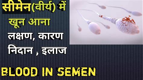 सीमेन वीर्य में खून आना Blood In Semen Explained In Hindi