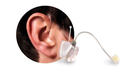 Hearing Aid Ear Molds