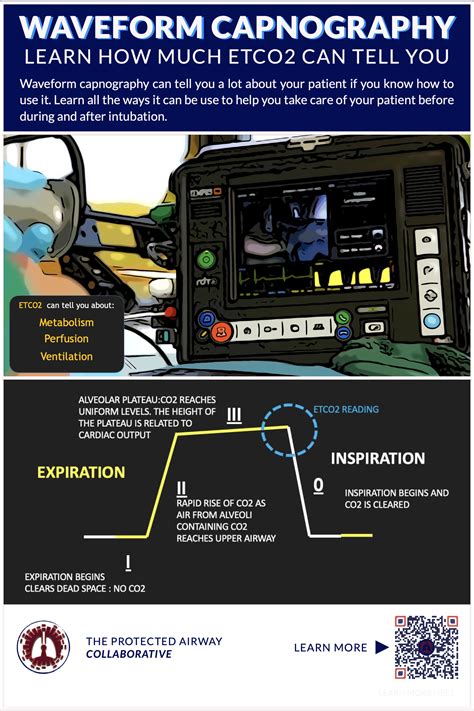 Waveform Capnography Masterclass – The Protected Airway Collaborative
