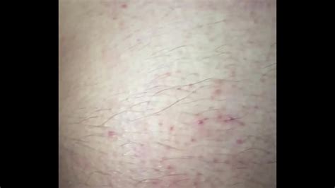 Corno Dando O Cu Videos Xvideos