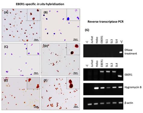 Viruses Free Full Text The Impact Of Deleting Stem Loop 1 Of Epsteinbarr Virus Encoded Rna